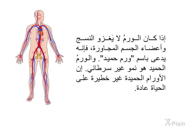 إذا كان الورمُ لا يَغزو النسج وأعضاء الجسم المجاورة، فإنه يدعى باسم "ورم حميد". والورمُ الحميد هو نمو غير سرطاني. إن الأورام الحميدة غير خطيرة على الحياة عادة.