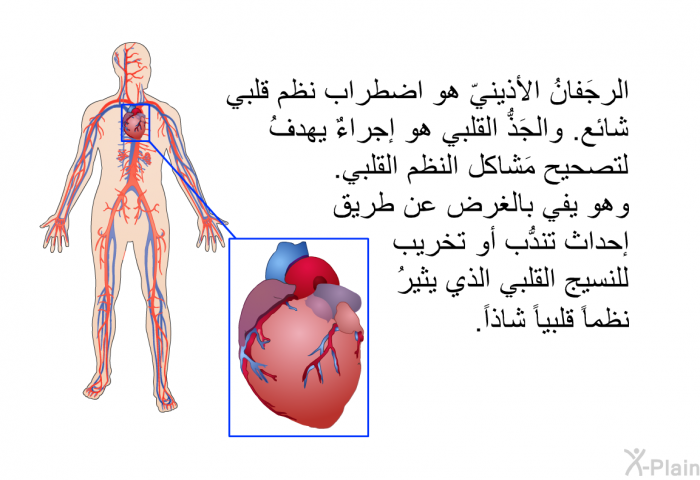 الرجَفانُ الأذينيّ هو اضطراب نظم قلبي شائع. والجَذُّ القلبي هو إجراءٌ يهدفُ لتصحيح مَشاكل النظم القلبي. وهو يفي بالغرض عن طريق إحداث تندُّب أو تخريب للنسيج القلبي الذي يثيرُ نظماً قلبياً شاذاً.