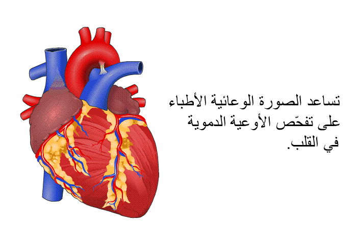 تساعد الصورة الوعائية الأطباء على تفحّص الأوعية الدموية في القلب.