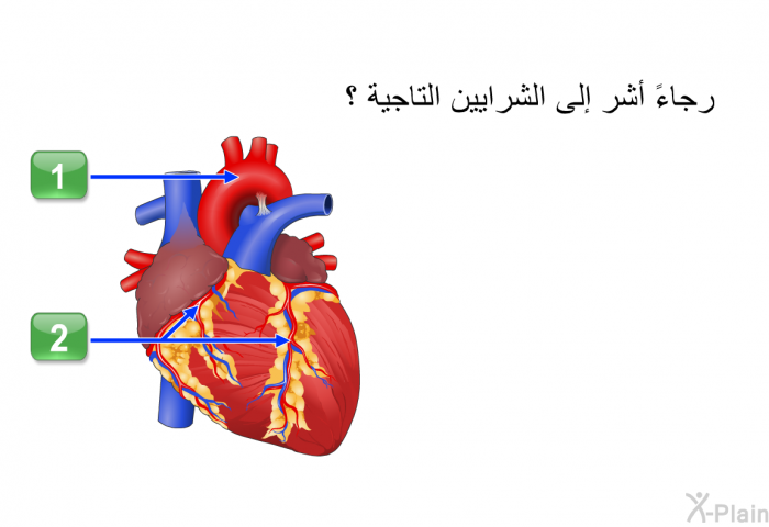 رجاءً أشر إلى الشرايين التاجية ؟