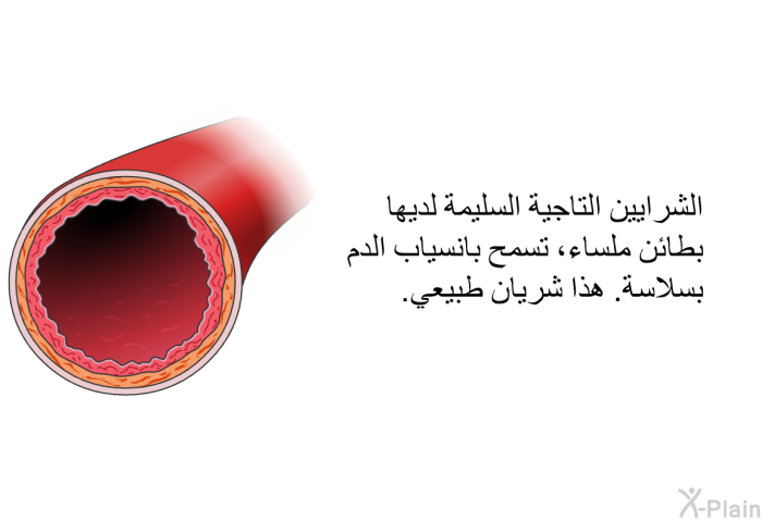 الشرايين التاجية السليمة لديها بطائن ملساء، تسمح بانسياب الدم بسلاسة. هذا شريان طبيعي.