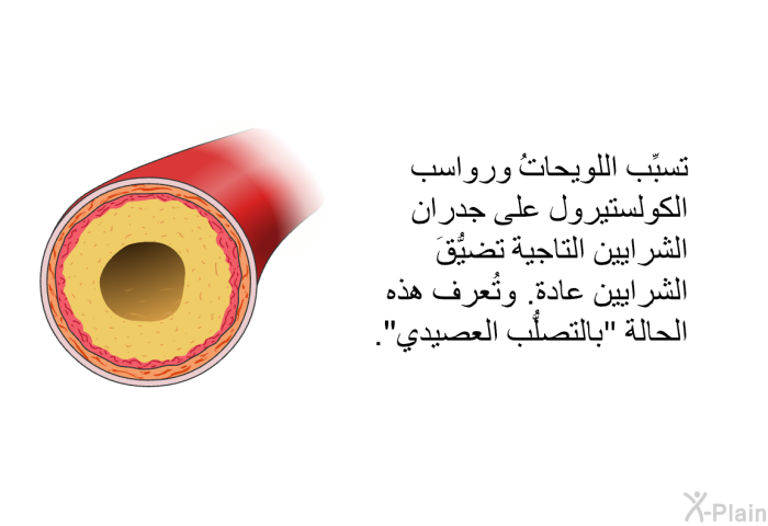 تسبِّب اللويحاتُ ورواسب الكولستيرول على جدران الشرايين التاجية تضيُّقَ الشرايين عادة. وتُعرف هذه الحالة "بالتصلُّب العصيدي".