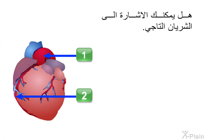 هل يمكنك الاشارة الى للشريان التاجي.