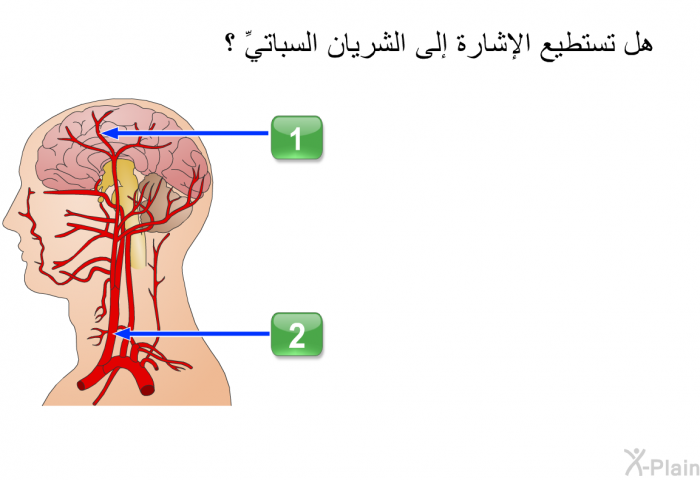 هل تستطيع الإشارة إلى الشريان السباتيِّ؟