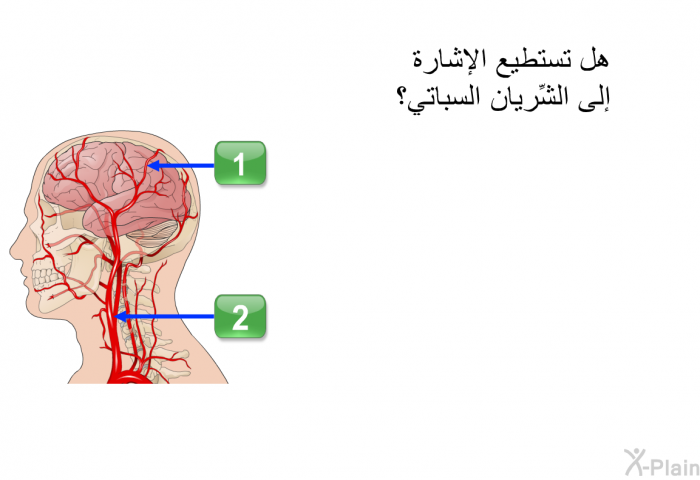 هل تستطيع الإشارة إلى الشِّريان السباتي؟