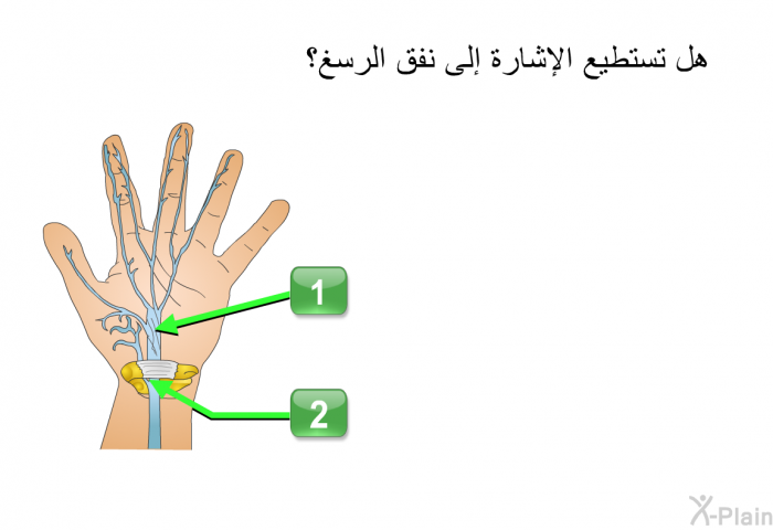 هل تستطيع الإشارة إلى نفق الرسغ؟