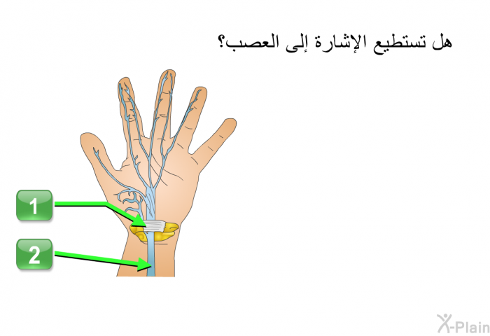 هل تستطيع الإشارة إلى العصب؟