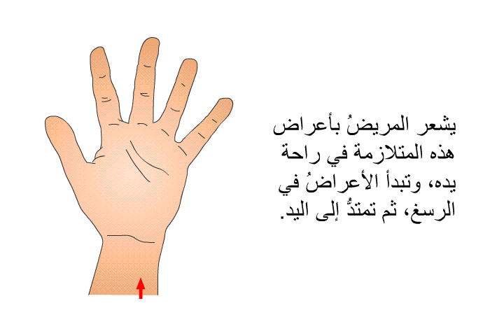 يشعر المريضُ بأعراض هذه المتلازمة في راحة يده، وتبدأ الأعراضُ في الرسغ، ثم تمتدُّ إلى اليد<B>.</B>