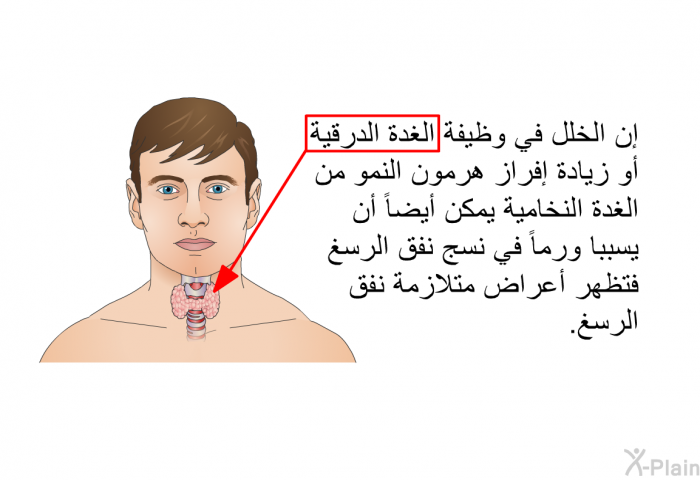 إن الخلل في وظيفة الغدة الدرقية أو زيادة إفراز هرمون النمو من الغدة النخامية يمكن أيضاً أن يسببا ورماً في نسج نفق الرسغ فتظهر أعراض متلازمة نفق الرسغ<B>.</B>