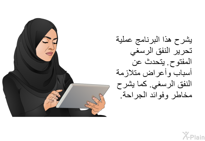 تشرح هذه المعلومات الصحية عملية تحرير النفق الرسغي المفتوح. تتحدث عن أسباب وأعراض متلازمة النفق الرسغي. كما تشرح مخاطر وفوائد الجراحة.