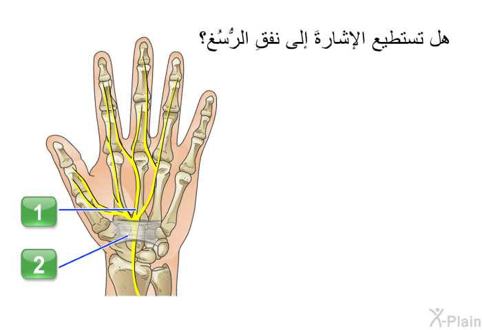 هل تستطيع الإشارةَ إلى نفقِ الرُّسُغ؟