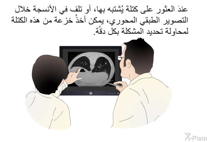 عندَ العثور على كتلة يُشتبه بها، أو تلف في الأنسجة خلال التصوير الطبقي المحوري، يمكن أخذُ خزعة من هذه الكتلة لمحاولة تحديد المشكلة بكل دقَّة.