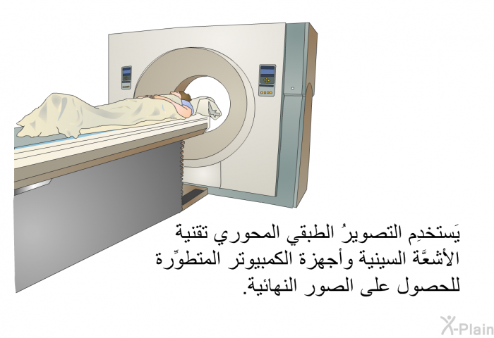 يَستخدِم التصويرُ الطبقي المحوري تقنيةَ الأشعَّة السينية وأجهزة الكمبيوتر المتطوِّرة للحصول على الصور النهائية.