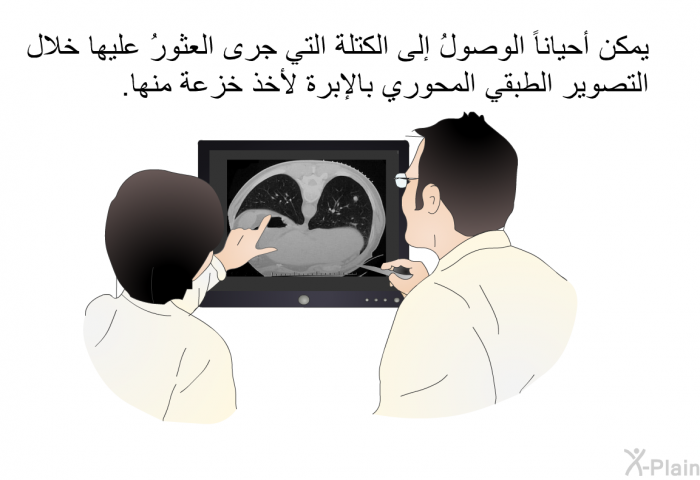 يمكن أحياناً الوصولُ إلى الكتلة التي جرى العثورُ عليها خلال التصوير الطبقي المحوري بالإبرة لأخذ خزعة منها.