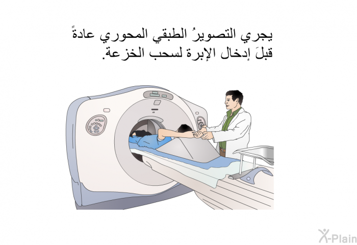 يجري التصويرُ الطبقي المحوري عادةً قبلَ إدخال الإبرة لسحب الخزعة.