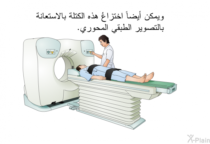 ويمكن أيضاً اختزاعُ هذه الكتلة بالاستعانة بالتصوير الطبقي المحوري.