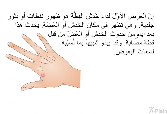 إنَّ العرض الأوَّل لداء خَدش القِطَّة هو ظهور نفطات أو بثور جلدية. وهي تظهر في مكان الخَدش أو العَضَّة. يحدث هذا بعد أيامٍ من حدوث الخَدش أو العَضِّ من قبل قطة مصابة. وقد يبدو شبيهاً بما تُسَبِّبه لسعاتُ البعوض.