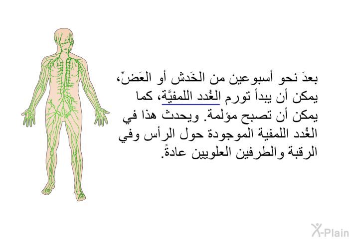 بعدَ نحو أسبوعين من الخَدش أو العَضِّ، يمكن أن يبدأ تورم الغُدد اللمفيَّة، كما يمكن أن تصبح مؤلمة. ويحدث هذا في الغُدد اللمفية الموجودة حول الرأس وفي الرقبة والطرفين العلويين عادةً.