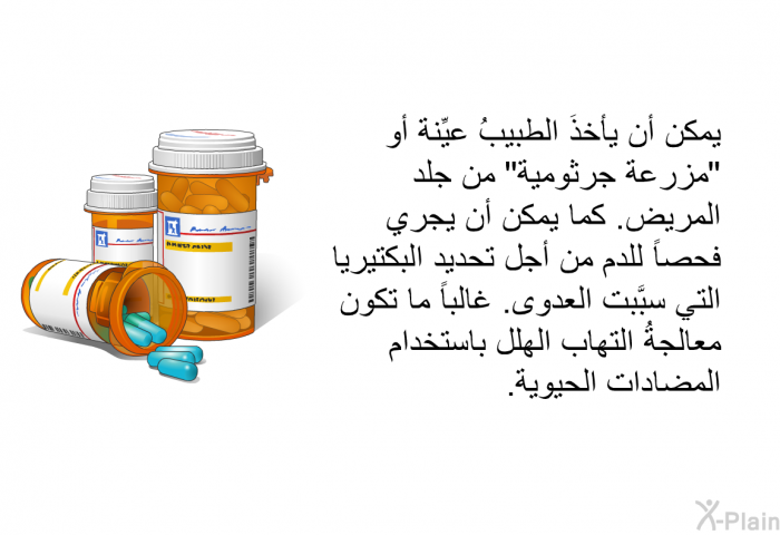 يمكن أن يأخذَ الطبيبُ عيِّنة أو "مزرعة جرثومية" من جلد المريض. كما يمكن أن يجري فحصاً للدم من أجل تحديد البكتيريا التي سبَّبت العدوى. غالباً ما تكون معالجةُ التهاب الهلل باستخدام المضادات الحيوية.