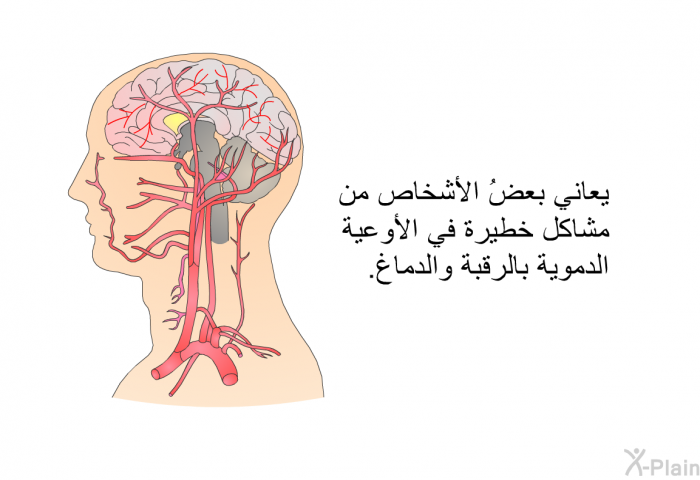 يعاني بعضُ الأشخاص من مشاكل خطيرة في الأوعية الدموية بالرقبة والدماغ.