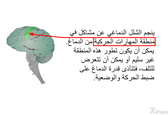 ينجم الشلل الدماغي عن مشاكل في منطقة المهارات الحركية من الدماغ. يمكن أن يكون تطور هذه المنطقة غير سليم أو يمكن أن تتعرض للتلف، فتتأذى قدرة الدماغ على ضبط الحركة والوضعية.