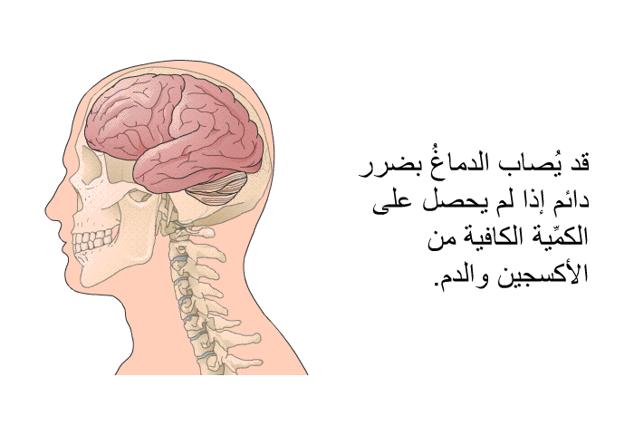 قد يُصاب الدماغُ بضرر دائم إذا لم يحصل على الكمِّية الكافية من الأكسجين والدم.