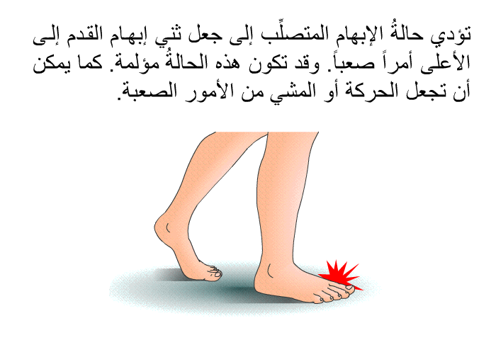 تؤدي حالةُ الإبهام المتصلِّب إلى جعل ثني إبهام القدم إلى الأعلى أمراً صعباً. وقد تكون هذه الحالةُ مؤلمة. كما يمكن أن تجعل الحركة أو المشي من الأمور الصعبة.