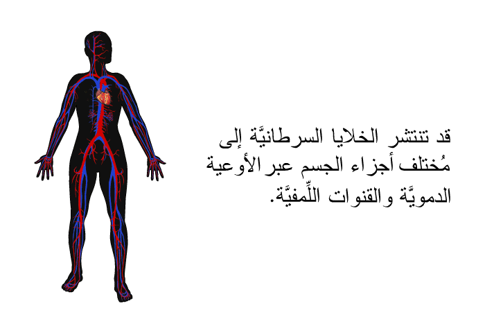 قد تنتشر الخلايا السرطانيَّة إلى مُختلف أجزاء الجسم عبر الأوعية الدمويَّة والقنوات اللِّمفيَّة.