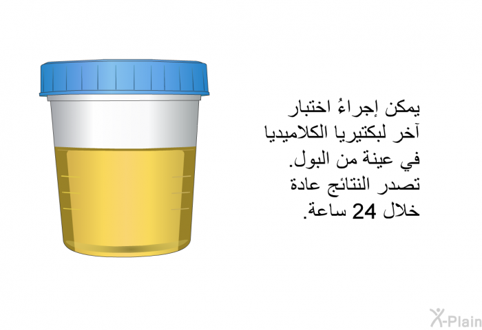 يمكن إجراءُ اختبار آخر لبكتيريا الكلاميديا في عينة من البول. تصدر النتائج عادة خلال 24 ساعة.