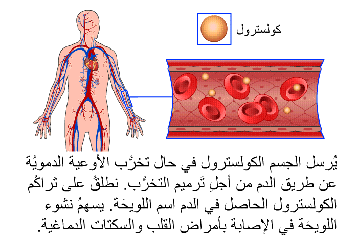 يُرسل الجسم الكولسترول في حال تخرُّب الأوعية الدمويَّة عن طريق الدم من أجلِ تَرميم التخرُّب. نطلقُ على تَراكُم الكولسترول الحاصل في الدم اسم اللويحَة. يسهمُ نشوء اللويحَة في الإصابة بأمراض القلب والسكتات الدماغية.