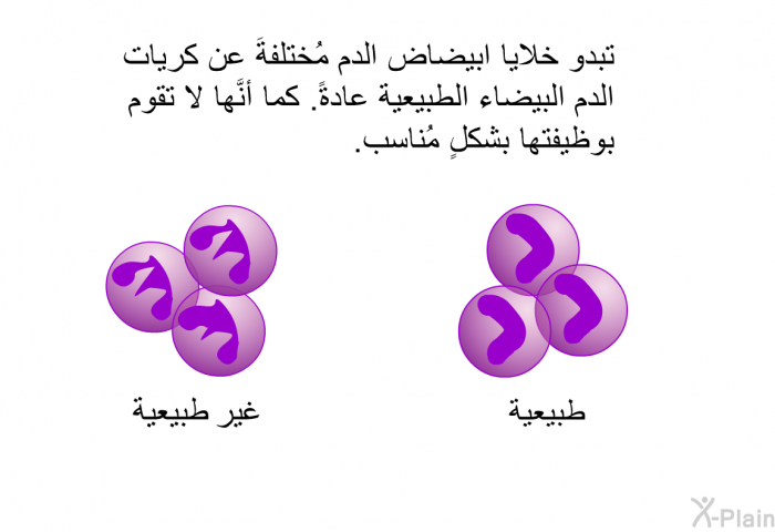 تبدو خلايا ابيضاض الدم مُختلفةَ عن كريات الدم البيضاء الطبيعية عادةً. كما أنَّها لا تقوم بوظيفتها بشكلٍ مُناسب.