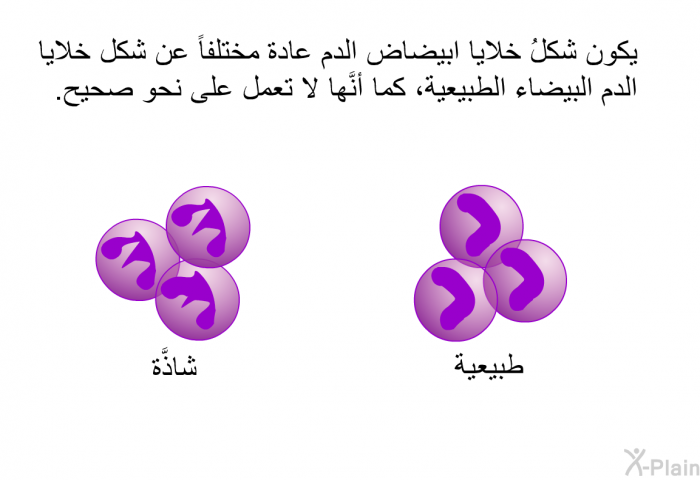 يكون شكلُ خلايا ابيضاض الدم عادة مختلفاً عن شكل خلايا الدم البيضاء الطبيعية، كما أنَّها لا تعمل على نحو صحيح.