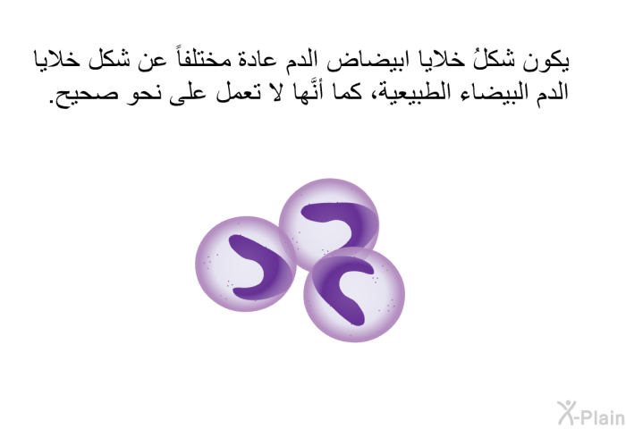 يكون شكلُ خلايا ابيضاض الدم عادة مختلفاً عن شكل خلايا الدم البيضاء الطبيعية، كما أنَّها لا تعمل على نحو صحيح.