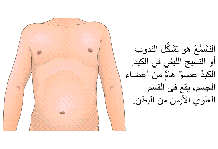 التشمُّعُ هو تشكُّل الندوب أو النسيج الليفي في الكبد. الكبدُ عضوٌ هامٌّ من أعضاء الجسم، يقع في القسم العلوي الأيمن من البطن.