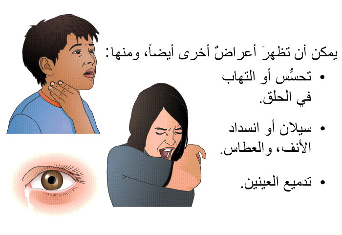 يمكن أن تظهرَ أعراض أخرى أيضاً، ومنها:   تحسُّس أو التهاب في الحلق.  سيلان أو انسداد الأنف، والعُطاس. تدميع العينين.