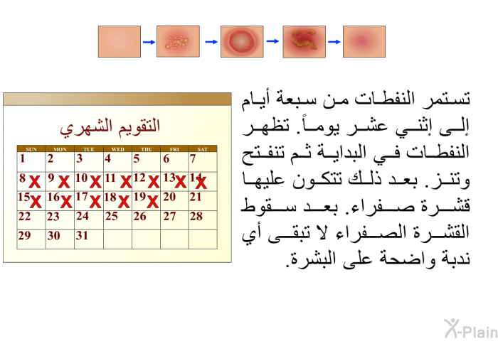 تستمر النفطات من سبعة أيام إلى اثني عشر يوماً. تظهر النفطات في البداية ثم تنفتح وتنز. بعد ذلك تتكون عليها قشرة صفراء. بعد سقوط القشرة الصفراء لا تبقى أي ندبة واضحة على البشرة.