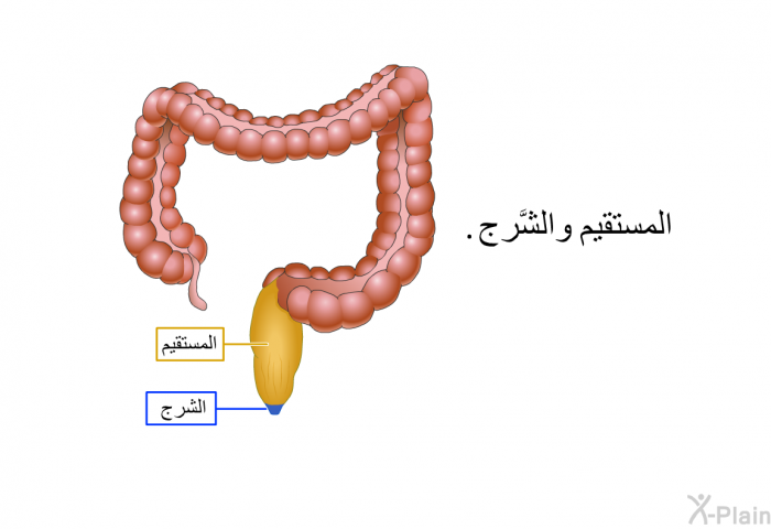 المستقيم والشَّرج.