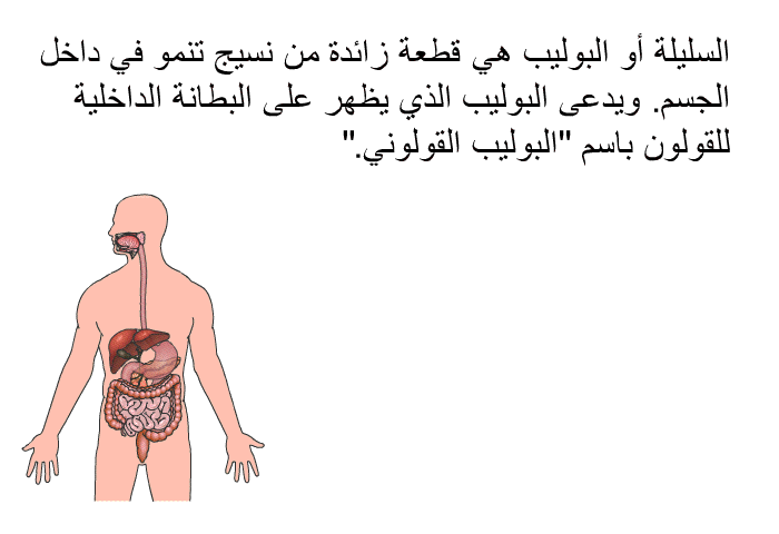 السليلة أو البوليب هي قطعة زائدة من نسيج تنمو في داخل الجسم. ويدعى البوليب الذي يظهر على البطانة الداخلية للقولون باسم "البوليب القولوني".