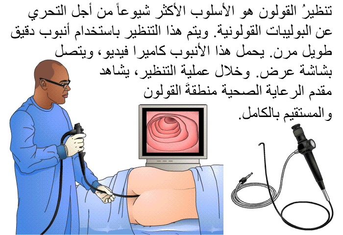 تنظيرُ القولون هو الأسلوب الأكثر شيوعاً من أجل التحري عن البوليبات القولونية. ويتم هذا التنظير باستخدام أنبوب دقيق طويل مرن. يحمل هذا الأنبوب كاميرا فيديو، ويتصل بشاشة عرض. وخلال عملية التنظير، يشاهد مقدم الرعاية الصحية منطقةَ القولون والمستقيم بالكامل.