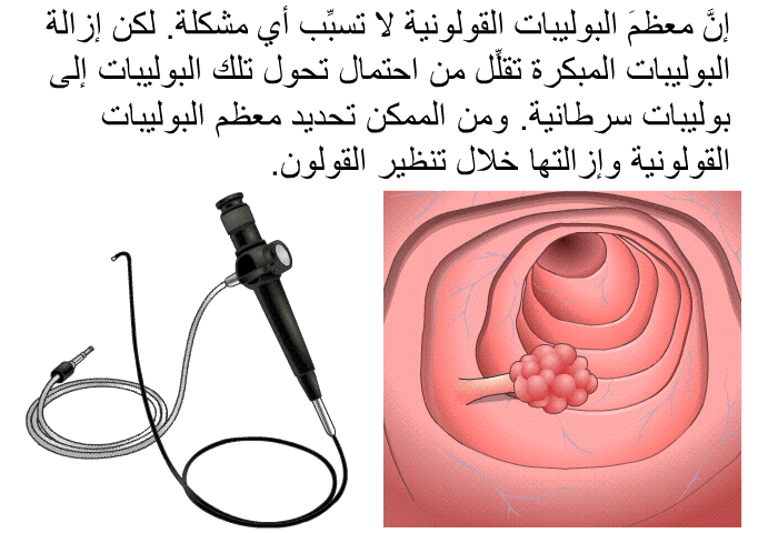 إنَّ معظمَ البوليبات القولونية لا تسبِّب أي مشكلة. لكن إزالة البوليبات المبكرة تقلِّل من احتمال تحول تلك البوليبات إلى بوليبات سرطانية. ومن الممكن تحديد معظم البوليبات القولونية وإزالتها خلال تنظير القولون.