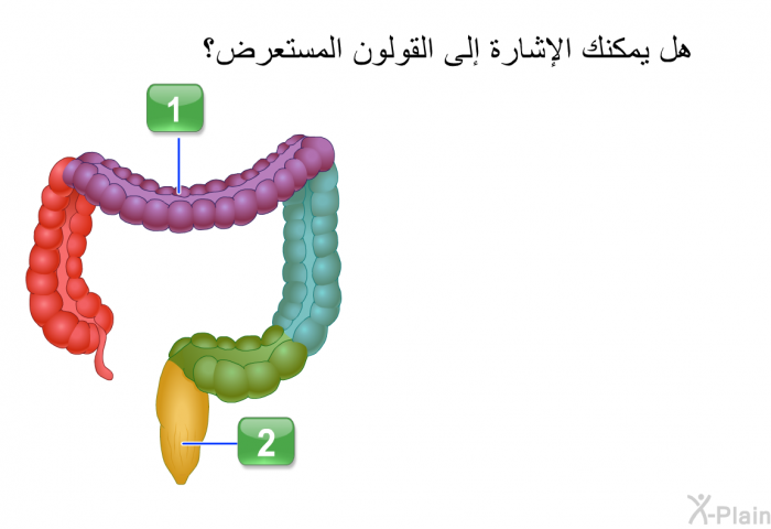 هل يمكنك الإشارة إلى القولون المستعرض؟