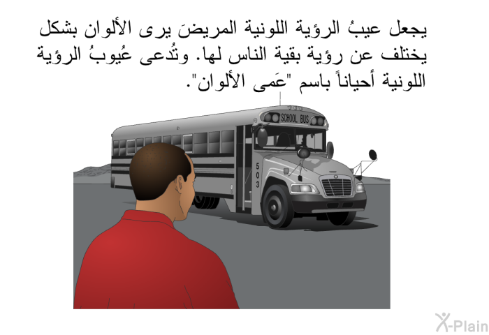 يجعل عيبُ الرؤية اللونية المريضَ يرى الألوان بشكل يختلف عن رؤية بقية الناس لها. وتُدعى عُيوبُ الرؤية اللونية أحياناً باسم "عَمى الألوان".