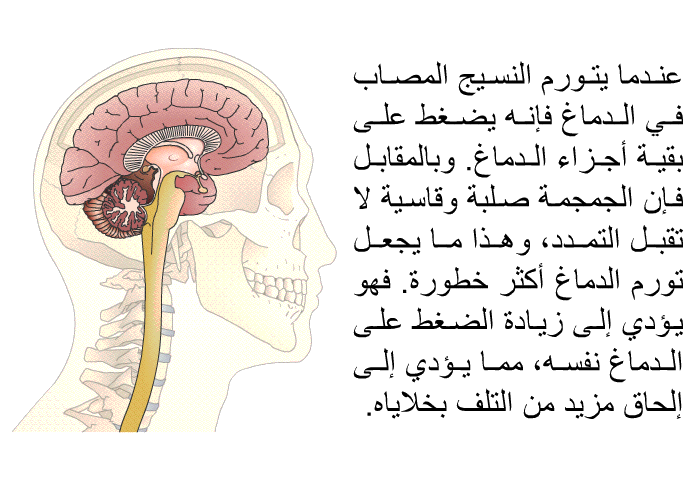 عندما يتورم النسيج المصاب في الدماغ فإنه يضغط على بقية أجزاء الدماغ. وبالمقابل فإن الجمجمة صلبة وقاسية لا تقبل التمدد، وهذا ما يجعل تورم الدماغ أكثر خطورة. فهو يؤدي إلى زيادة الضغط على الدماغ نفسه، مما يؤدي إلى إلحاق مزيد من التلف بخلاياه.