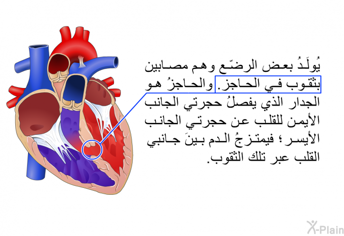 يُولَدُ بعض الرضّع وهم مصابين بثقوب في الحاجز. والحاجزُ هو الجدار الذي يفصلُ حجرتي الجانب الأيمن للقلب عن حجرتي الجانب الأيسر؛ فيمتزجُ الدم بينَ جانبي القلب عبر تلك الثقوب.