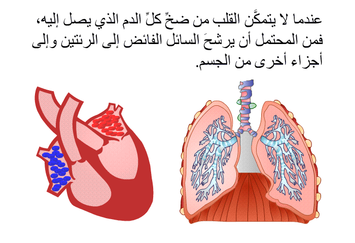 عندما لا يتمكَّن القلب من ضخِّ كلِّ الدم الذي يصل إليه، فمن المحتمل أن يُرَشّحَ السائل الفائض إلى الرئتين وإلى أجزاء أخرى من الجسم.