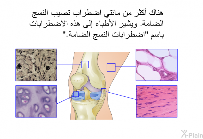 هناك أكثر من مائتي اضطراب تصيب النسج الضامة. ويشير الأطباء إلى هذه الاضطرابات باسم "اضطرابات النسج الضامة".