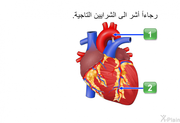 رجاءاً أشر الى الشرايين التاجية<B>.</B>