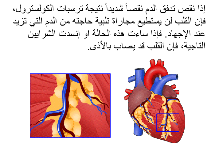 إذا نقص تدفق الدم نقصاً شديداً نتيجة ترسبات الكولسترول، فإن القلب لن يستطيع مجاراة تلبية حاجته من الدم التي تزيد عند الإجهاد<B>. </B>فإذا ساءت هذه الحالة او إنسدت الشرايين التاجية، فإن القلب قد يصاب بالأذى<B>.</B>