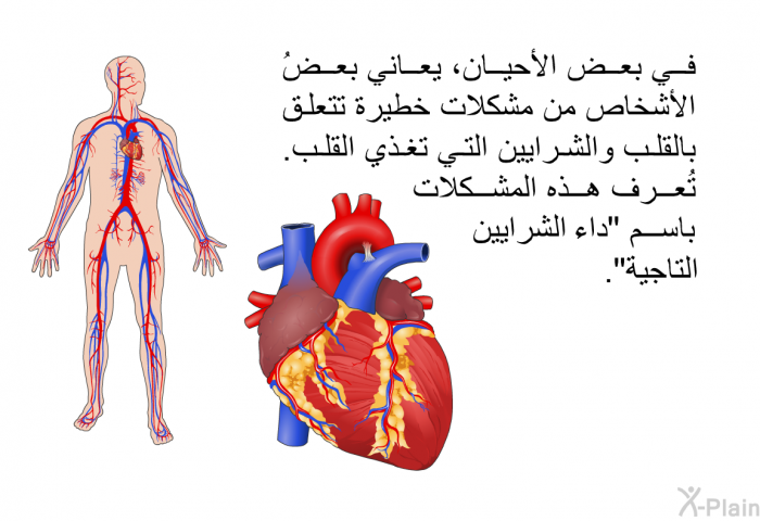 في بعض الأحيان، يعاني بعضُ الأشخاص من مشكلات خطيرة تتعلق بالقلب والشرايين التي تغذي القلب. تُعرف هذه المشكلات باسم "داء الشرايين التاجية".