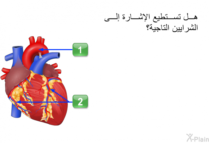 هل تستطيع الإشارة إلى الشرايين التاجية؟